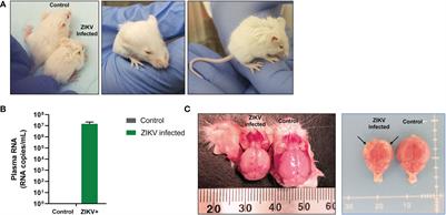 Zika virus induced microcephaly and aberrant hematopoietic cell differentiation modeled in novel neonatal humanized mice